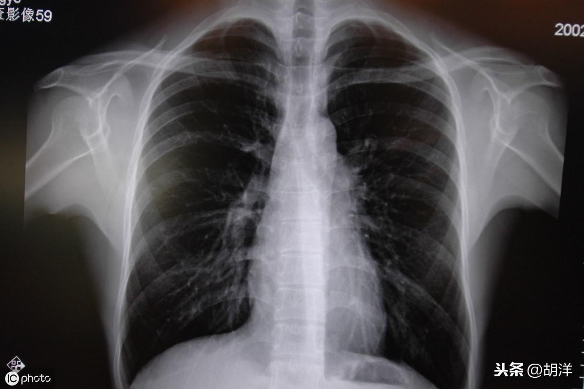 炎最新报告,自然美景探索之旅,寻求内心平和与宁静的旅程